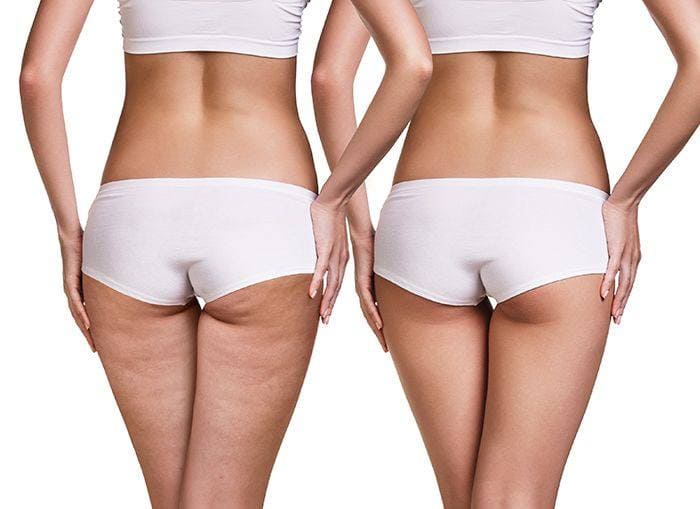 crema anticelulitis 4d crema anticelulitis 4d